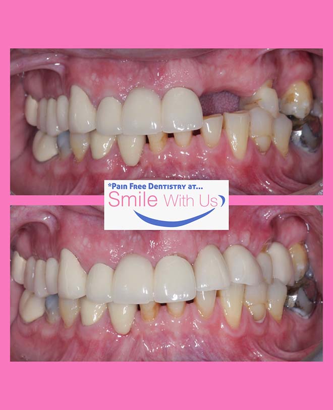 Before - smilewithus